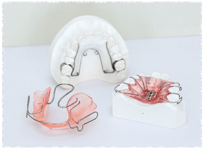 矯正治療｜【宝塚市の歯医者】歯科・小児歯科・こどもの小児矯正はとがわ歯科クリニック│売布・ダイエー宝塚中山店